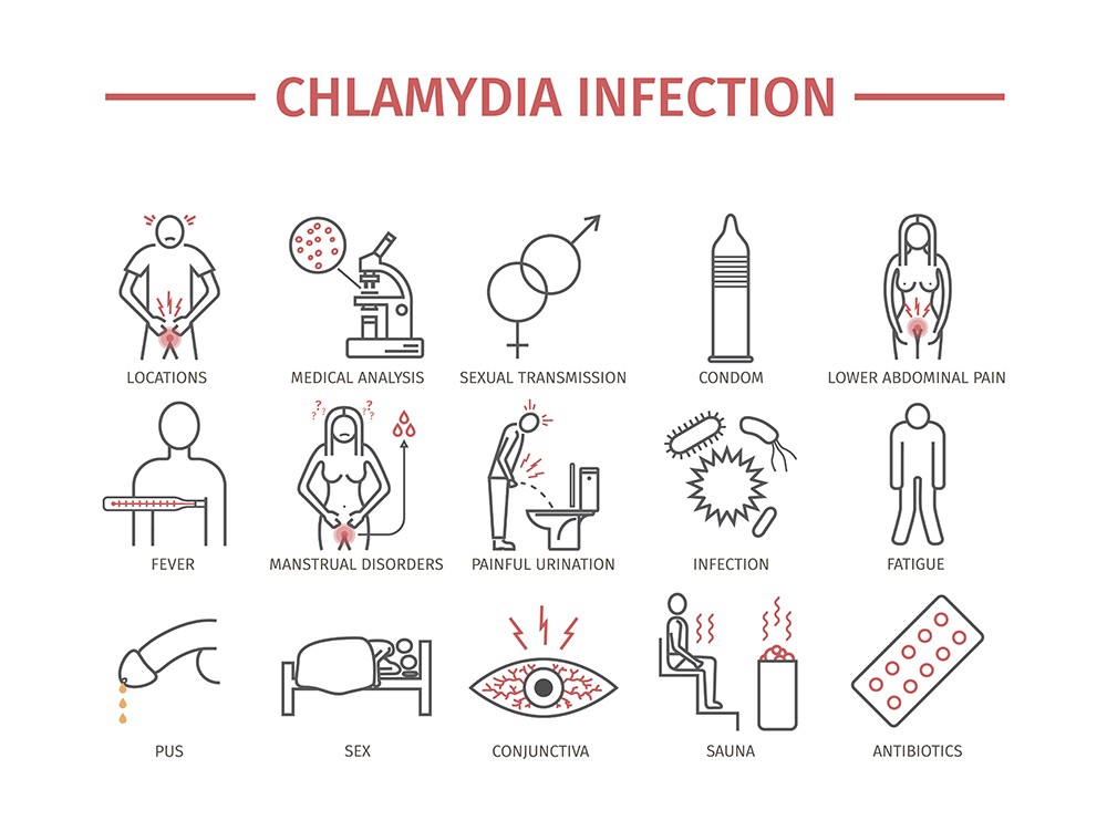 Chlamydia In Men Symptoms Diagnosis Treatments