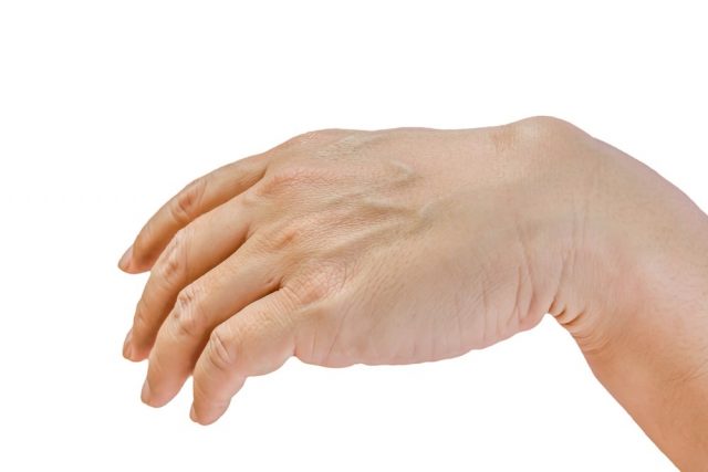 Ganglion cyst on man hand