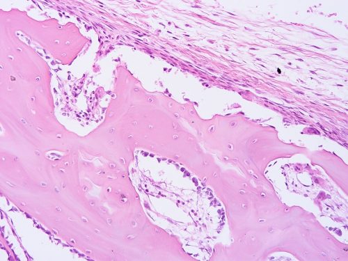 Do Women Have A Prostate: Histology of human tissue
