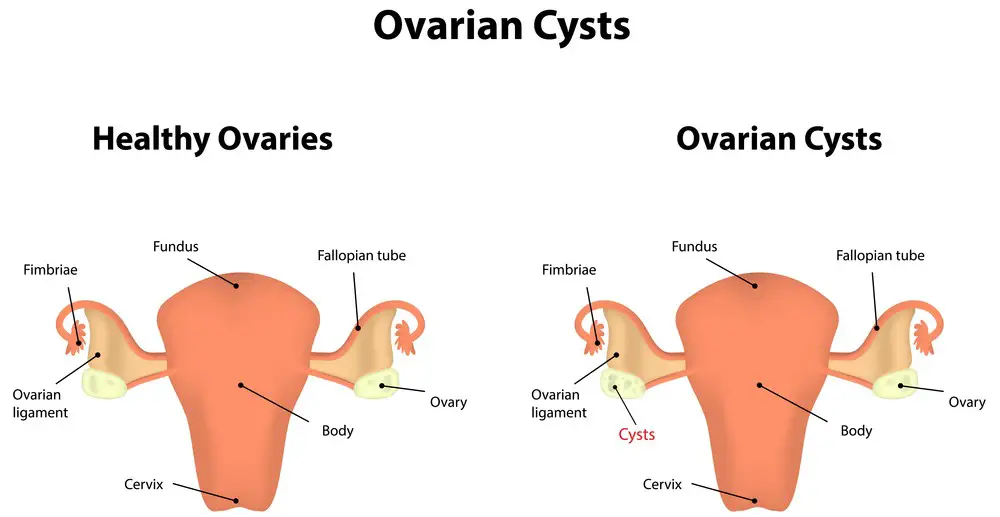 Do Women Have A Prostate Facts You Should Know 