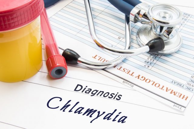 Making the Diagnosis for Chlamydia