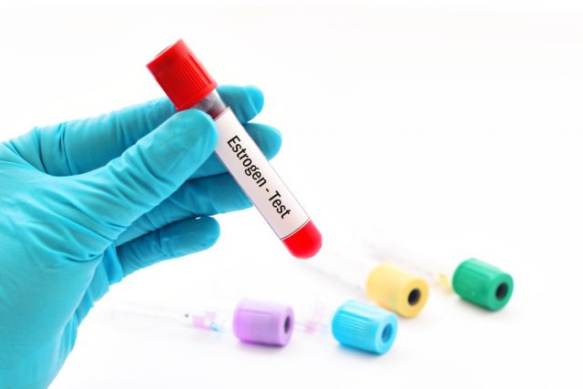 Blood sample for estrogen (female hormone) test