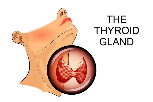 Female Weight Gain: Illustration of ultrasound diagnostics of thyroid diseases