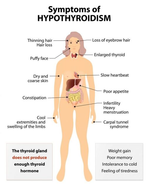 Female Weight Gain: Signs and Symptoms thyroid dysfunction