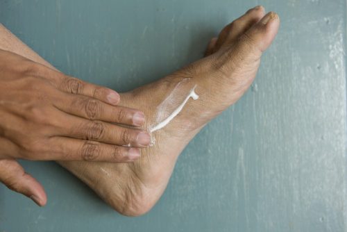 Foot rash: Moisturising