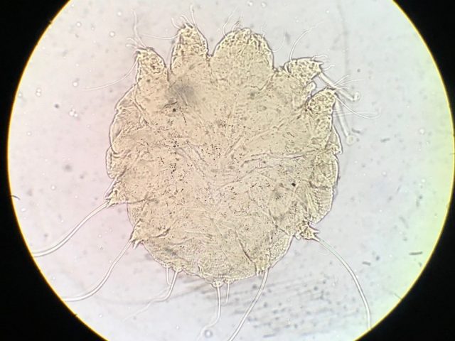 Scabies in light microscope