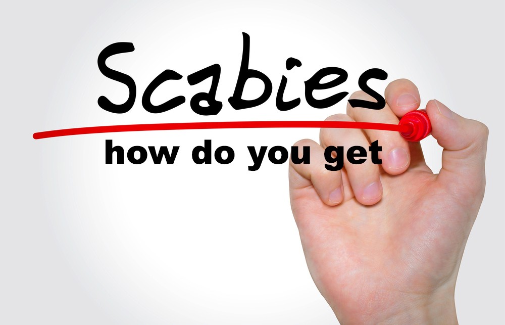How Do You Get Scabies
