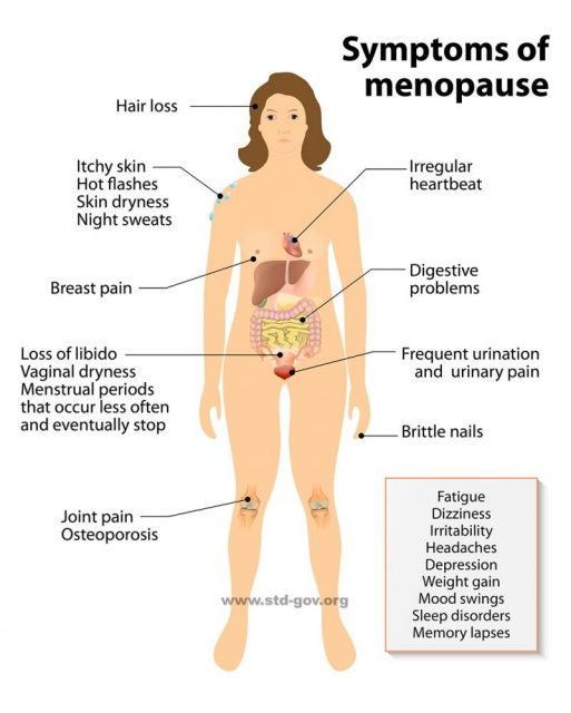 Menopause infographic. Sign and Symptoms.