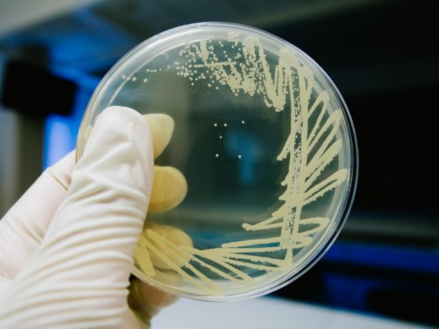 Yeast cultivation on agar medium plate in microbiology laboratory