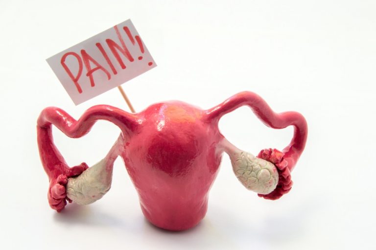 Ovary Pain major causes, anatomy, treatment options