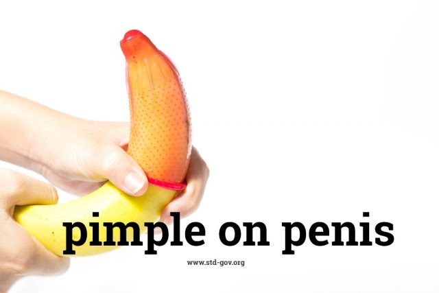 Pimple on penis