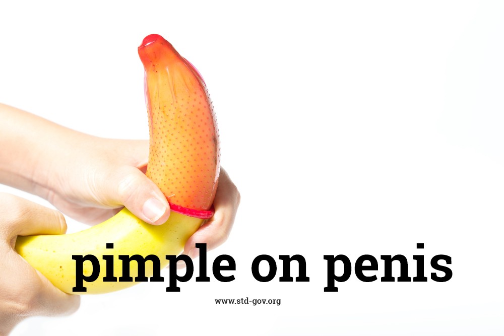 Small Bump Penis 106