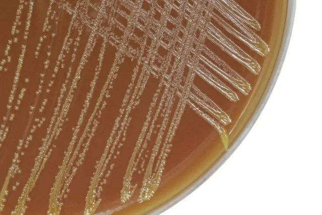 Neisseria gonorrhoeae bacterial colonies on chocolate agar plate