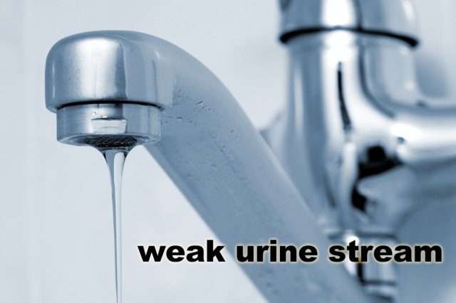 Weak Urine Stream