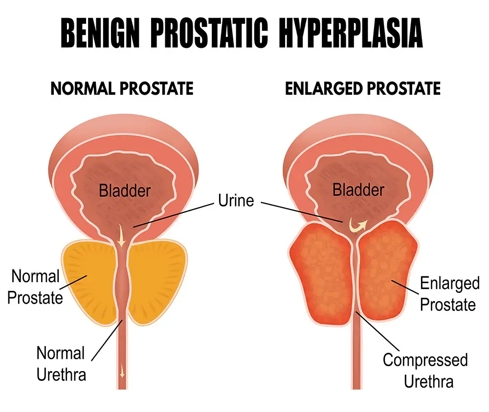 Peeing sensation during ejaculations