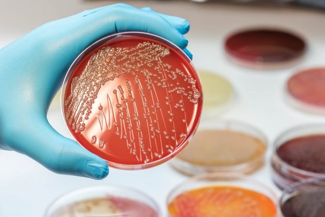 Escherichia coli colonies, Gram negative bacilli colonies as test on Blood agar plate