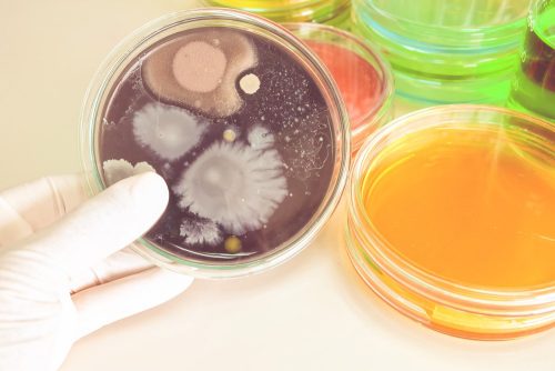 Yellow Discharge | causes, types, anatomy, images