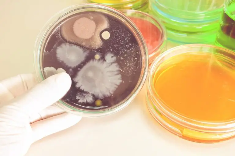 Yellow Discharge causes, types, anatomy, images