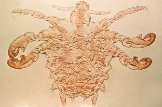 Phthirus pubis, or more commonly known as the pubic, or crab louse