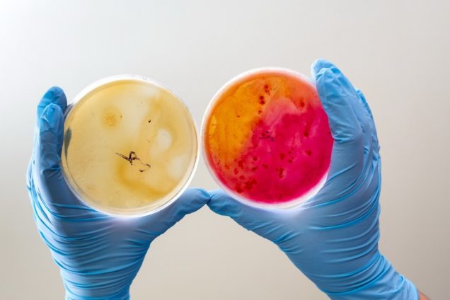 Laboratory technician tests for bacterial infection analyzes microorganisms growth Lab worker's hand holds test sample in Petri dishes