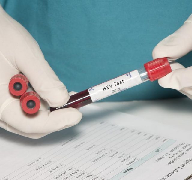 Blood collection tube with HIV test label held by technician