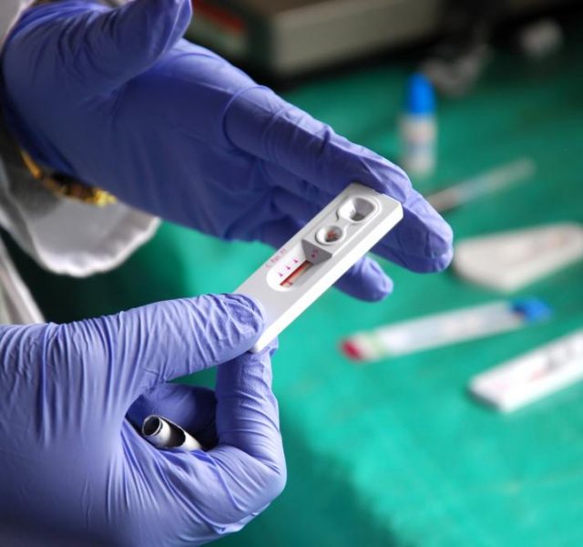 HIV test at Pomerini in Tanzania - Africa - A doctor examines the blood to find out the positive to the AIDS virus