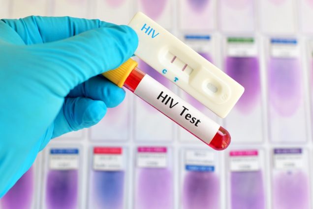 HIV test