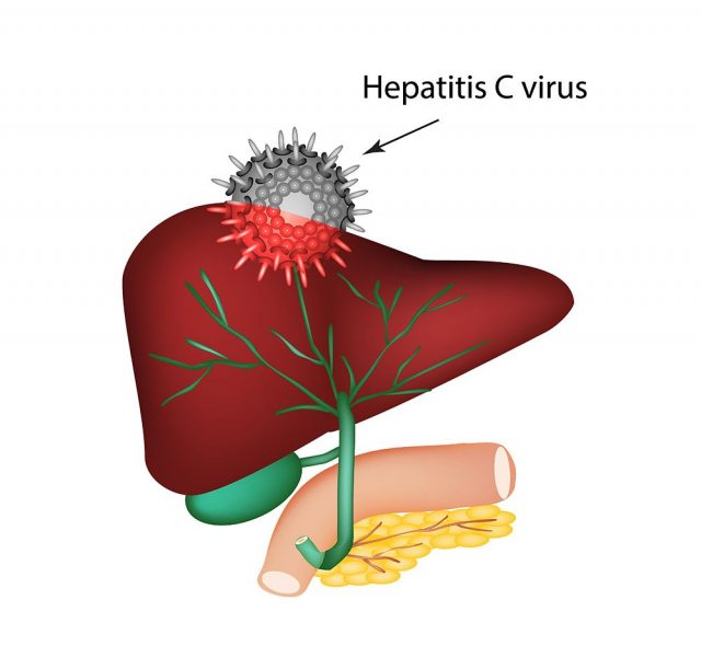 Hepatitis C. The introduction of the hepatitis C virus in the liver. The structure of the digestive system. Gallbladder. Pancreas. Bile ducts. Duodenum. World Hepatitis Day. Vector illustration.