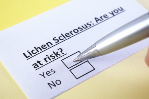 Lichen sclerosus: Vaginal Itching, Burning and Irritation