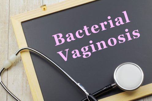 Bacterial Vaginosis: Vaginal Itching, Burning and Irritation