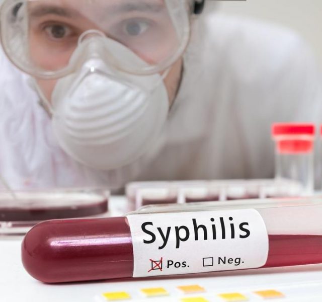 Syphilis Testing