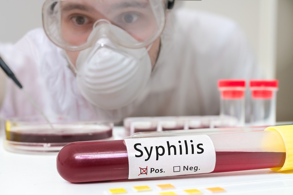  что показывает анализ после лечения сифилиса