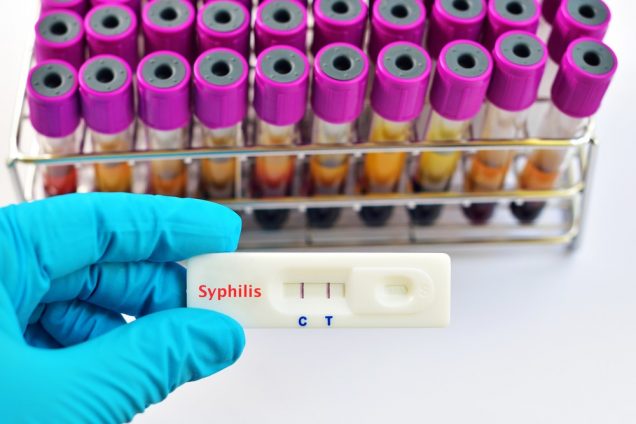 Syphilis test