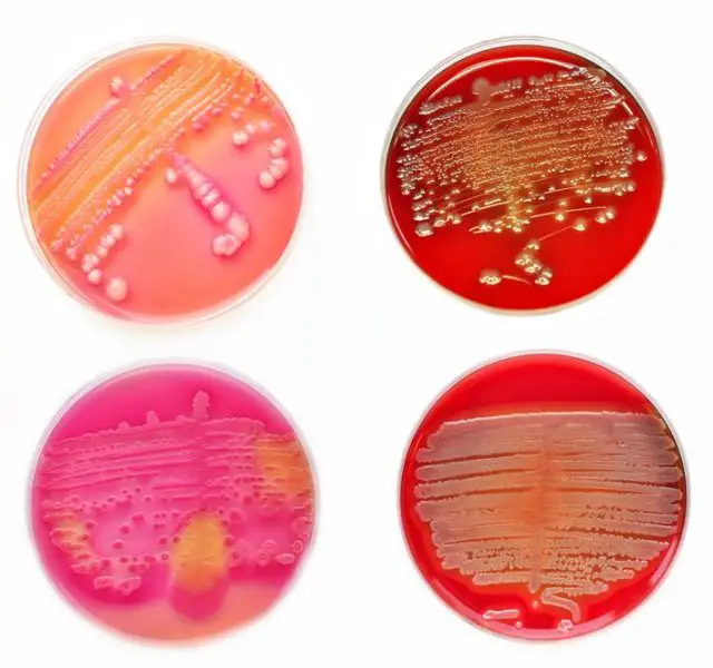 Trichomonas vaginalis: Colonies of bacteria in culture medium plate