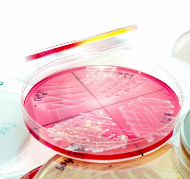 Trichomoniasis: Pink Bacteria colonies culture growth on XLD agar media in experimental laboratory Hospital