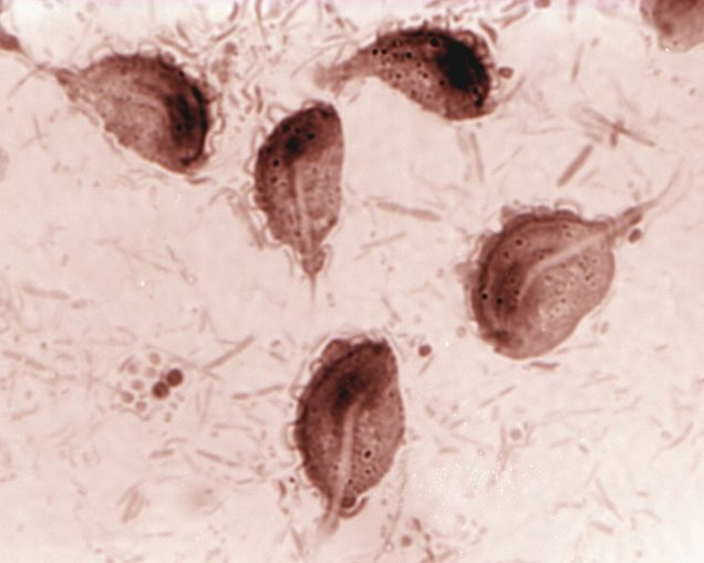 Trichomoniasis