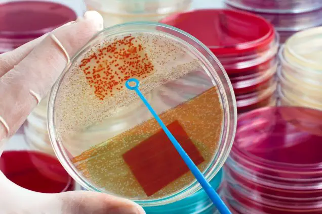 Technician holding plate with bacterial colonies in the laboratory