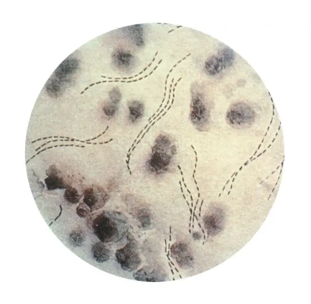 This illustration depicts a photomicrographic view of Haemophilus ducreyi bacteria stained using gentian violet