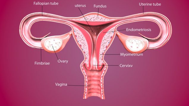 Complications of Chlamydia - Female reproductive system.3D render