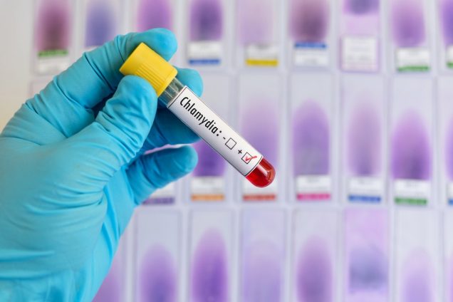 Testing of Chlamydia