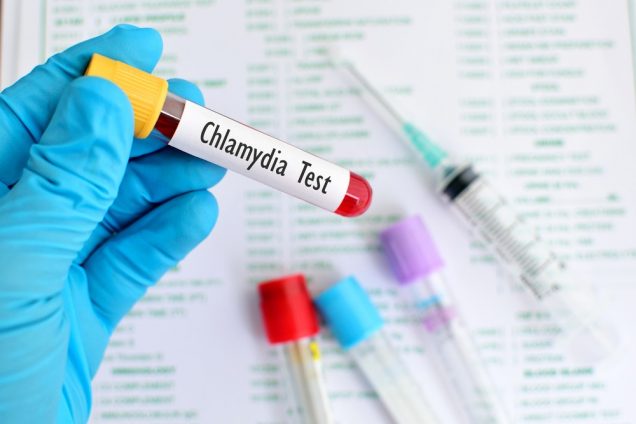 Chlamydia test