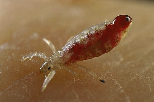 Crabs STD Pubic Lice Detailed Pictures Images