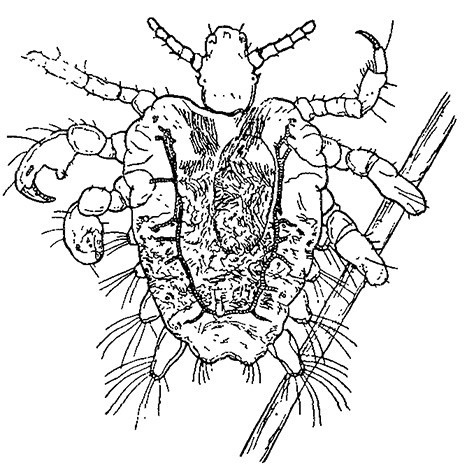 crabs STD (pubic lice) 7