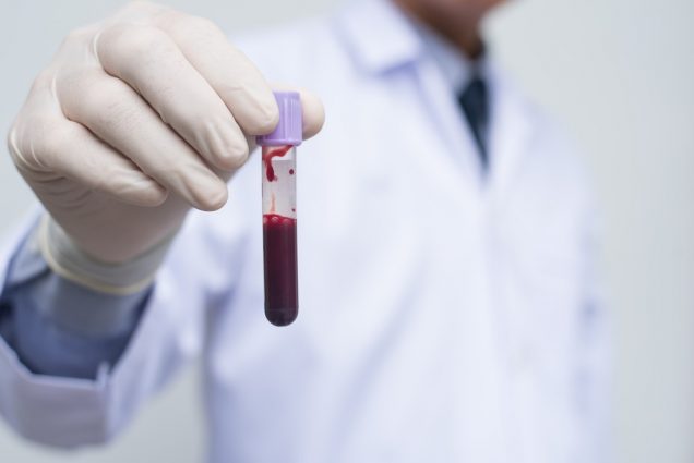 Blood presence causes dark urine