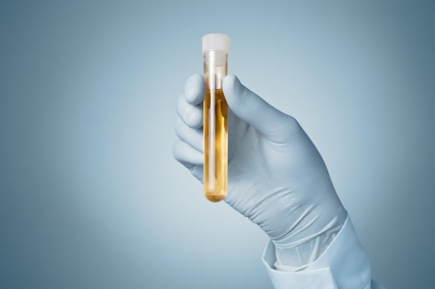 Doctor holding a bottle of urine sample