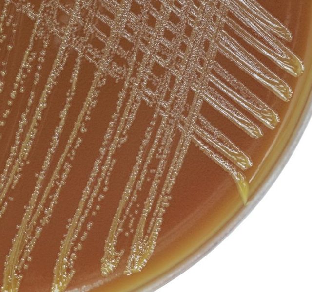 Neisseria gonorrhoeae bacterial colonies on chocolate agar plate