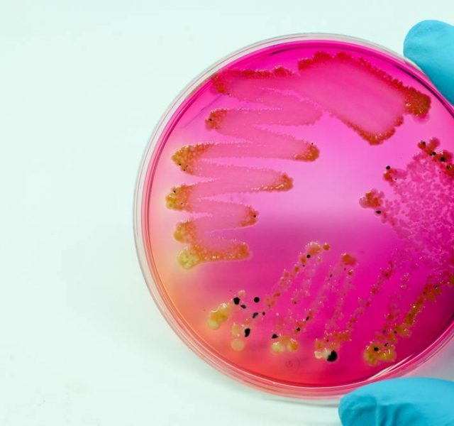 Gonorrhea: Yellow bacteria lactose ferment colony on agar experiment microbiology