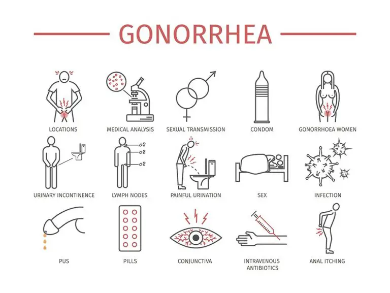 gonorrhea symptoms on penis gonorrhea symptoms on penis