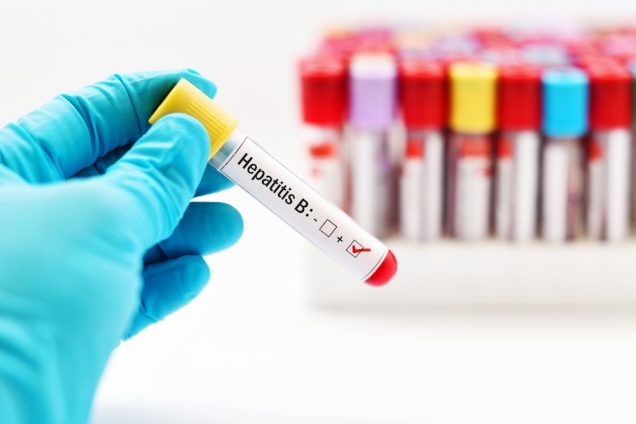 Hepatitis B test