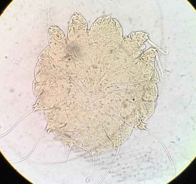 Scabies in light microscope
